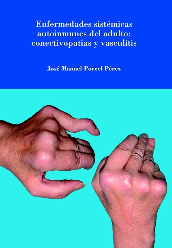 Enfermedades sistémicas autoinmunes del adulto: conectivopatías y vasculitis. | 9788484092056 | Porcel Pérez, Jose Manuel | Llibres.cat | Llibreria online en català | La Impossible Llibreters Barcelona